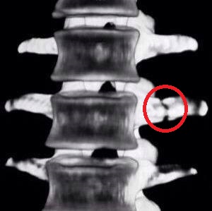 写真引用：portal noar